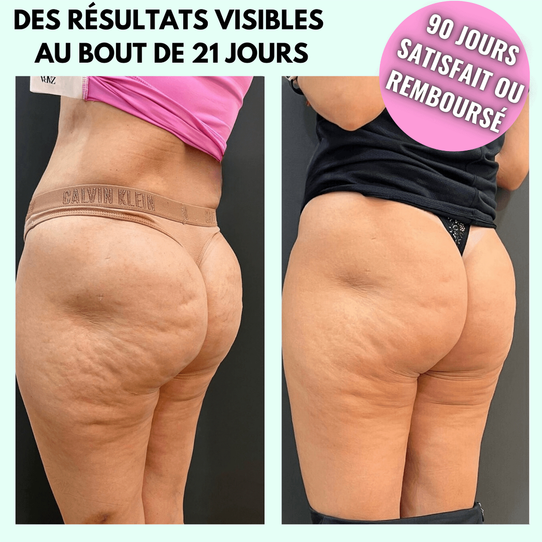 Vibra Pro™ – Appareil Anti-Cellulite & Massage Sculptant