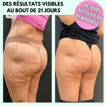 Vibra Pro™ – Appareil Anti-Cellulite & Massage Sculptant