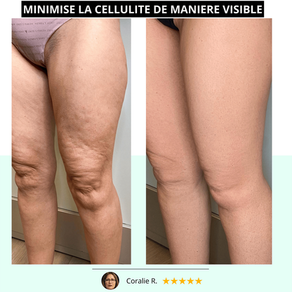 Vibra Pro™ – Appareil Anti-Cellulite & Massage Sculptant