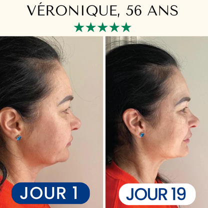 FontanaySkin™– Masque Liftant Réutilisable