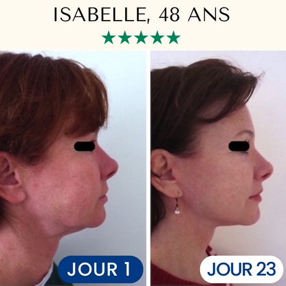 FontanaySkin™– Masque Liftant Réutilisable