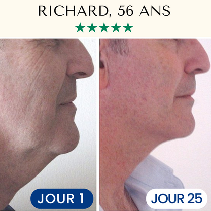 FontanaySkin™– Masque Liftant Réutilisable