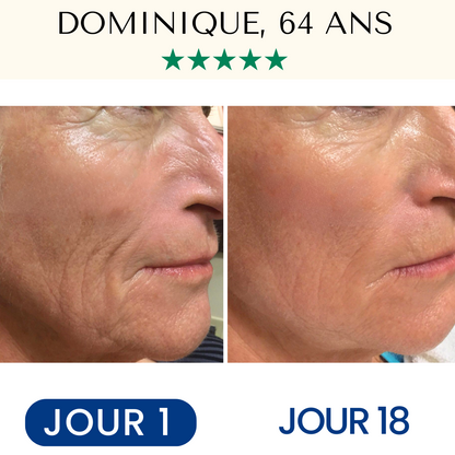 FontanaySkin™– Masque Liftant Réutilisable