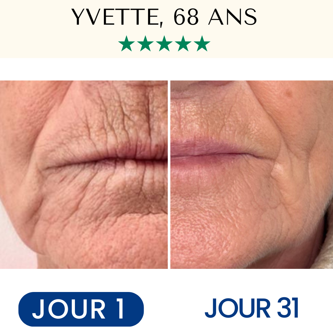 FontanaySkin™– Masque Liftant Réutilisable